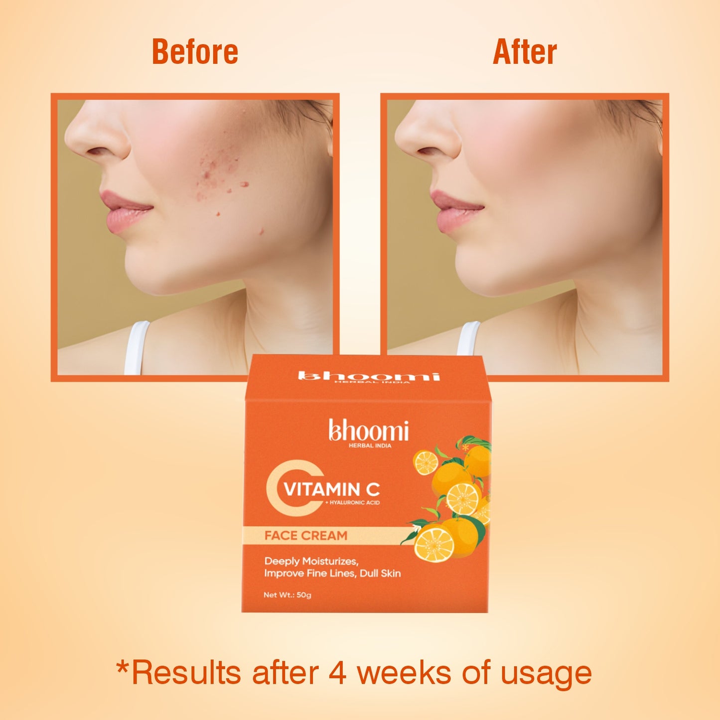 Bhoomi Herbal India Vitamin C + Hyaluronic Acid Face Cream (50gm)