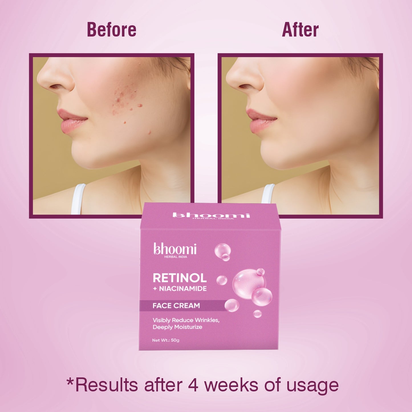 Bhoomi Herbal India Retinol + Niacinamide Face Cream (50gm)